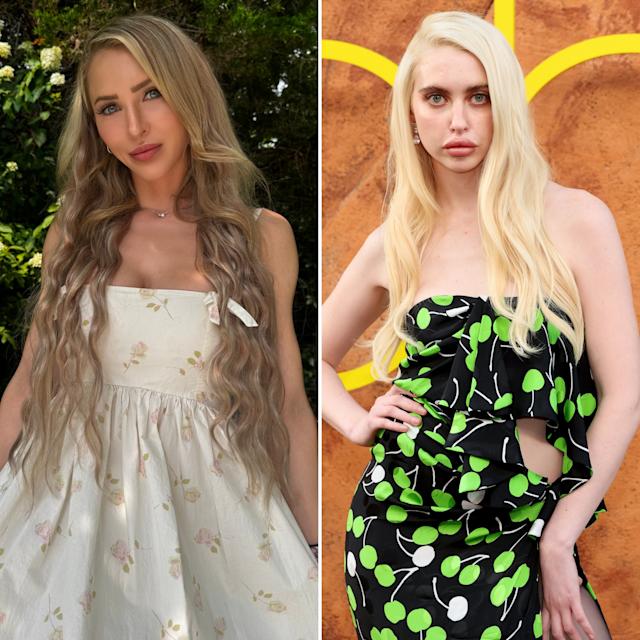 ALIX LYNX SLAMS CHLOE CHERRY: 'Euphoria' Star's OnlyFans RANT Is Pure HATE!